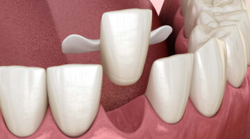 3D rendering of a Maryland bridge with wings