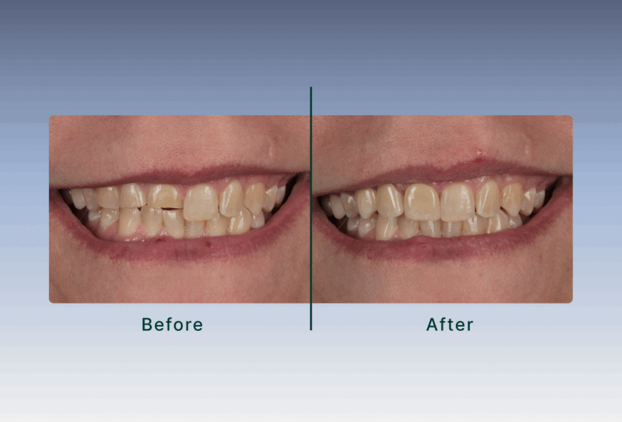 Dr. Sherberg case study smile image