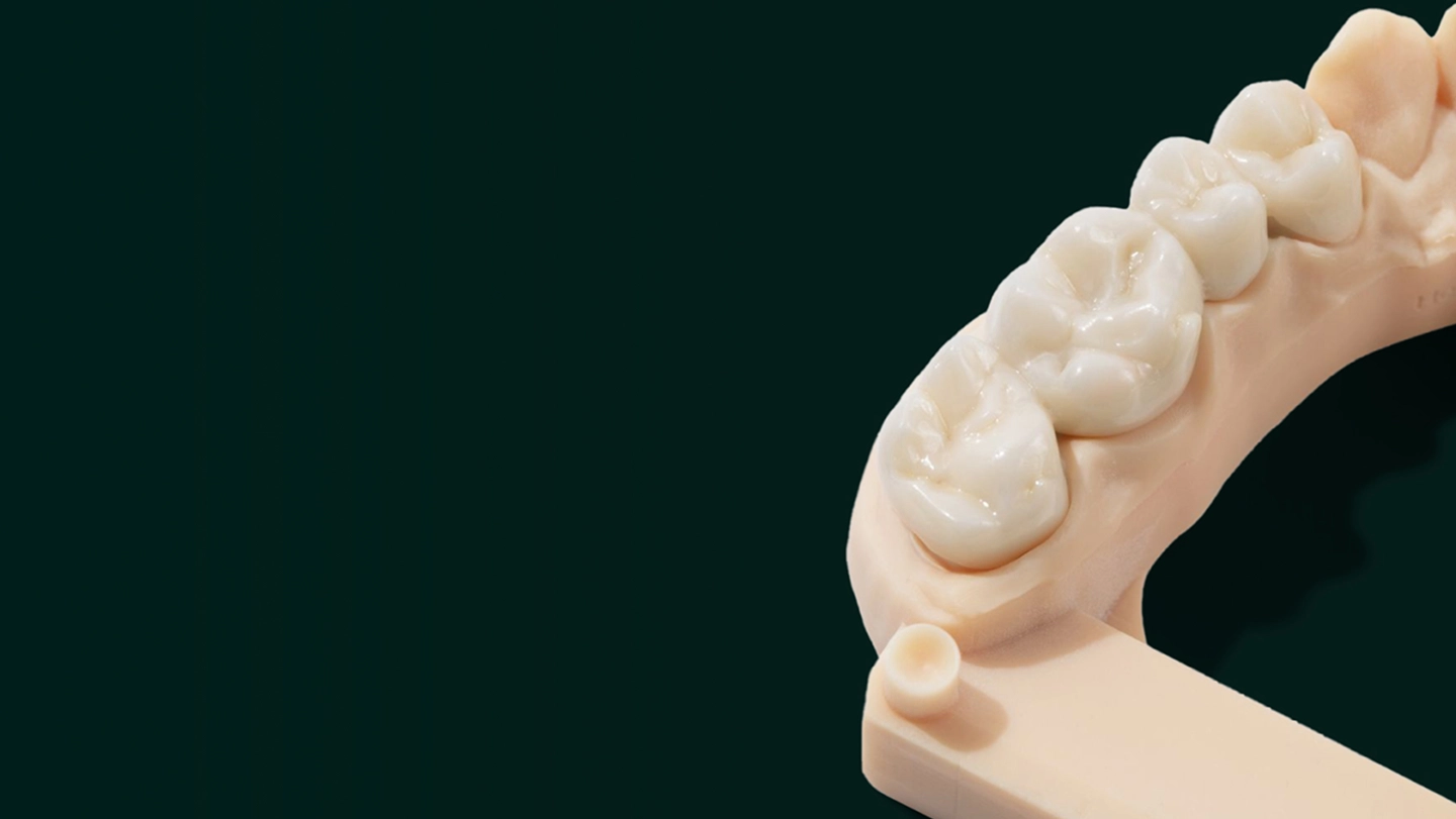 Dandy crown and bridge hero